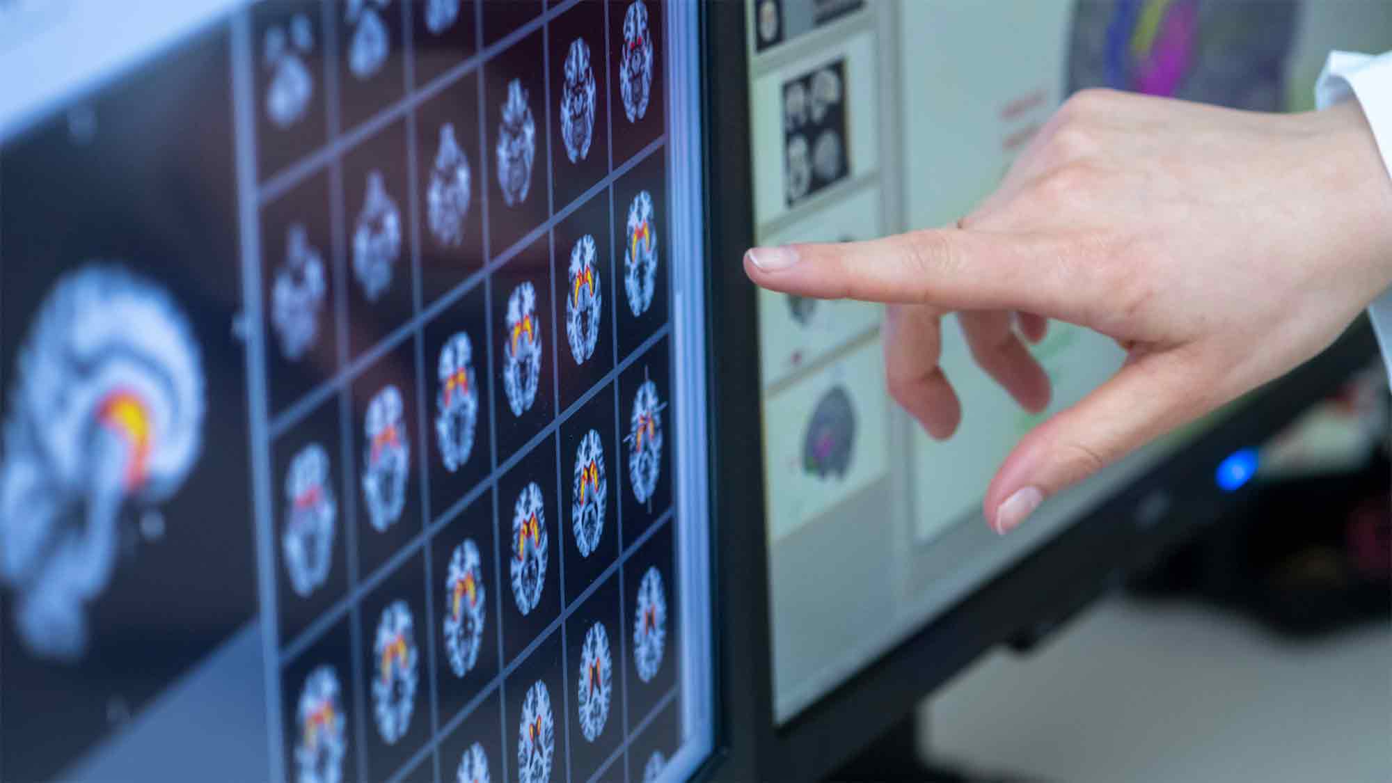 Langsames Atmen kann die Gehirnaktivität und das Entscheidungsverhalten beeinflussen Langsames Atmen kann die Gehirnaktivität und das Entscheidungsverhalten beeinflussen
