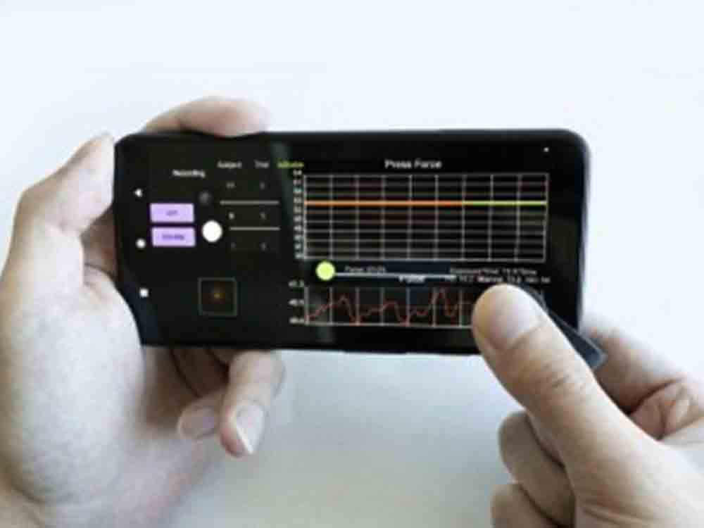 Eigenes Handy wird zum Blutdruckmesser, Ansatz der University of California San Diego funktioniert mit einem 3D-gedruckten Zusatzgerät
