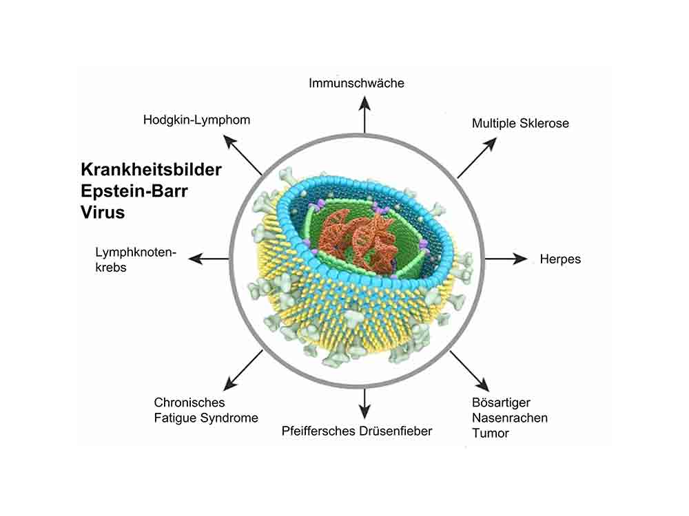 Welle von Long Covid und Krebserkrankungen als Folge eines Vitamin D Mangels durch Covid 19 Infektionen Welle von Long Covid und Krebserkrankungen als Folge eines Vitamin D Mangels durch Covid 19 Infektionen