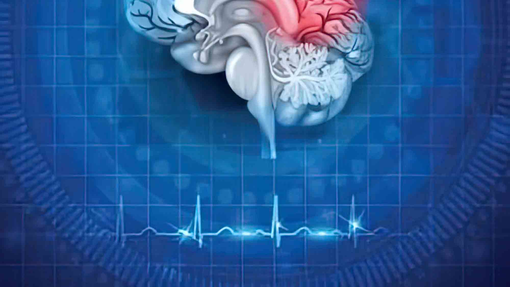 Gehirnerschütterungen: Headset misst Folgen