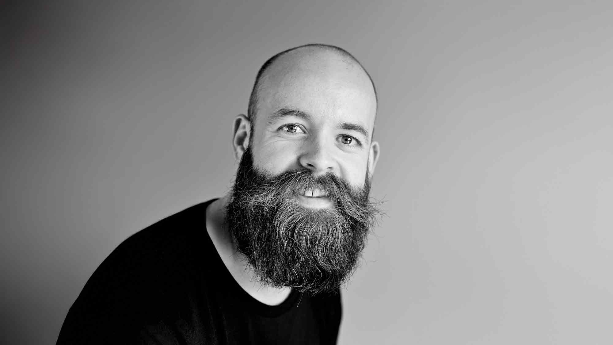 Haarchirurg verrät, wie sich Alopezie auf Ihre Augenbrauen auswirken kann